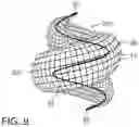 Fig. 12 - Micro-macro endovascular occlusion device and methodology