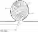 Fig. 33 - Micro-macro endovascular occlusion device and methodology