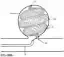 Fig. 35 - Micro-macro endovascular occlusion device and methodology