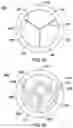 Fig. 02 - Devices for treating calcified heart valves
