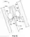 Fig. 09 - Devices for treating calcified heart valves