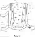 Fig. 02 - Heel protector and corresponding rehabilitation systems and methods for using the same