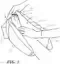Fig. 04 - Heel protector and corresponding rehabilitation systems and methods for using the same
