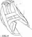 Fig. 07 - Heel protector and corresponding rehabilitation systems and methods for using the same