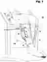 Fig. 02 - Portable system for the prophylaxis of deep vein thrombosis