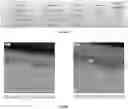 Fig. 43 - Coated drug compositions and methods of preparing the same