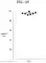 Fig. 10 - Natural killer cells exhibiting increased anticancer activity and immunotherapeutic use thereof