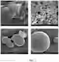 Fig. 04 - Spherical agglomeration of proteins