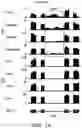 Fig. 02 - Antisense oligonucleotide-based progranulin augmentation therapy in neurodegenerative diseases