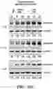 Fig. 33 - Antisense oligonucleotide-based progranulin augmentation therapy in neurodegenerative diseases