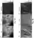 Fig. 07 - METHODS AND DEVICES FOR DETECTING A STIMULATED-RAMAN-SCATTERING (SRS) SIGNAL IN A SAMPLE