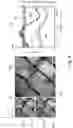 Fig. 08 - METHODS AND DEVICES FOR DETECTING A STIMULATED-RAMAN-SCATTERING (SRS) SIGNAL IN A SAMPLE