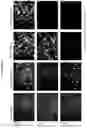 Fig. 09 - Compositions and methods for detecting protease activity in biological systems