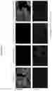 Fig. 12 - Compositions and methods for detecting protease activity in biological systems