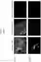 Fig. 20 - Compositions and methods for detecting protease activity in biological systems