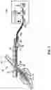 Fig. 02 - Methods, systems, and devices for improved sensors for continuous glucose monitoring