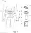 Fig. 02 - Transcutaneous analyte sensor systems and methods