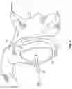 Fig. 08 - Patient-specific cutting guide for the shoulder