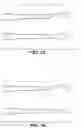 Fig. 02 - Instruments and methods for subperiosteal tunneling and related surgical procedures