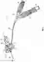 Fig. 02 - Catheter vent assembly and related systems and methods