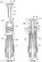 Fig. 09 - Catheter vent assembly and related systems and methods