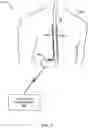 Fig. 02 - Control policy settings for electrical stimulation therapy