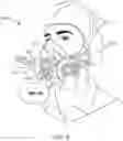 Fig. 10 - RESPIRATOR MASK WITH EXHALATION FILTER