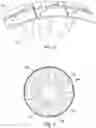 Fig. 03 - Electric module for an aircraft fan comprising blades with improved attachment