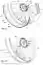Fig. 07 - Electric module for an aircraft fan comprising blades with improved attachment