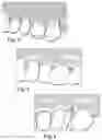 Fig. 03 - Anatomic apparatus and training system for remote and interactive hands-on surgical training for dentists