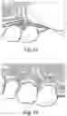 Fig. 06 - Anatomic apparatus and training system for remote and interactive hands-on surgical training for dentists