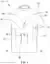 Fig. 02 - VENTRICULAR ASSIST DEVICE CONTROLLER HOLDING GARMENT ASSEMBLY