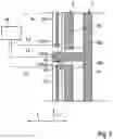 Fig. 03 - Multifunctional use of an electrode structure of a balloon catheter system