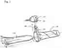 Fig. 02 - Guidance system mounts for surgical introducers