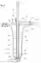 Fig. 06 - Guidance system mounts for surgical introducers