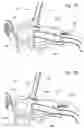Fig. 07 - Guidance system mounts for surgical introducers