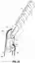 Fig. 07 - SURGICAL DEVICE FOR GRASPING AND SHEARING