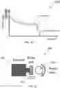 Fig. 12 - Method and system for controlling rotational speed of an agitator or catheter