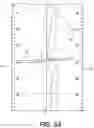 Fig. 49 - Bone stabilization systems