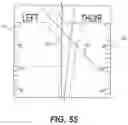 Fig. 50 - Bone stabilization systems