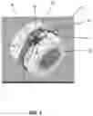 Fig. 02 - System and method for bone fixation