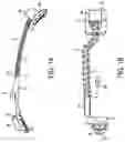 Fig. 02 - Orthodontic molar distalizer