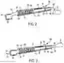 Fig. 05 - Orthodontic molar distalizer