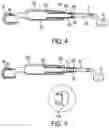 Fig. 06 - Orthodontic molar distalizer