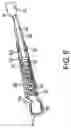 Fig. 07 - Orthodontic molar distalizer