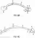 Fig. 10 - Orthodontic molar distalizer