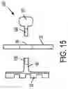 Fig. 15 - Orthodontic molar distalizer