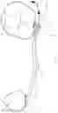 Fig. 17 - Orthodontic molar distalizer