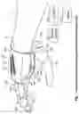 Fig. 02 - Prosthetic socket