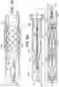 Fig. 07 - Implantable medical device detachment system with flexible braid section